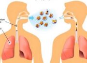 Infeksi Mycobacterium Tuberculosis dan Dampaknya