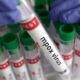 Pemerintah Targetkan Empat Kelompok Rentan untuk Vaksinasi Mpox