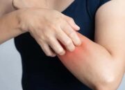 Mengenali Ciri-Ciri Gatal Akibat Diabetes dan Cara Mengatasinya