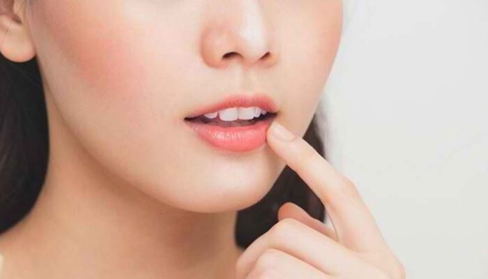 Tips Alami Merawat Bibir Kering Tanpa Lip Balm